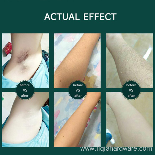 Ice Cooling IPL Hair Removal